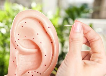 Нарушения слуха и иглоукалывание - есть ли польза