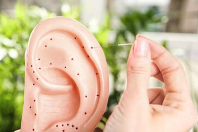 Нарушения слуха и иглоукалывание - есть ли польза